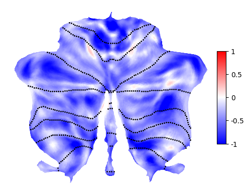 ../_images/tutorials_2.quickstart_anatomical_15_1.png