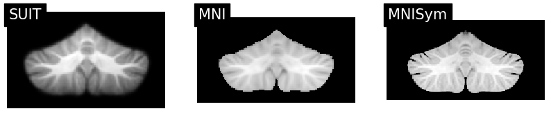../_images/tutorials_4.normalize_example_16_1.png