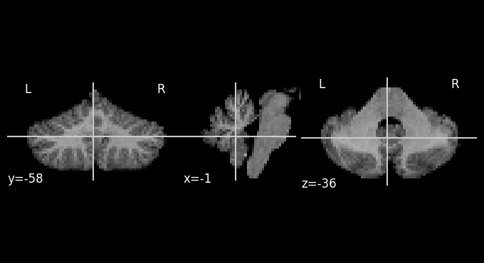 ../_images/tutorials_5.reslice_example_11_1.png