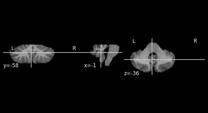 ../_images/tutorials_5.reslice_example_15_1.png