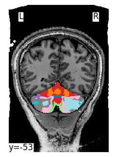 ../_images/tutorials_5.reslice_example_21_1.png