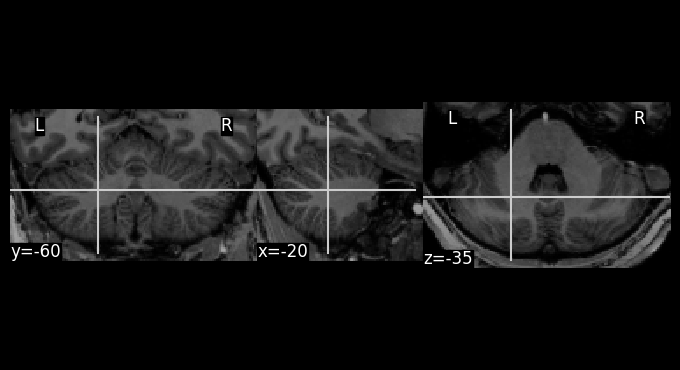 ../_images/tutorials_5.reslice_example_4_1.png
