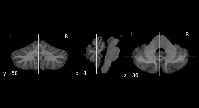 ../_images/tutorials_5.reslice_example_8_1.png